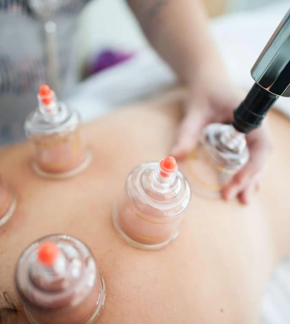 Schmerztherapie mit Schröpftherapie in der Praxis am Marienplatz, mit Schwerpunkt auf psychischer Gesundheit und naturheilkundlichen Ansätzen